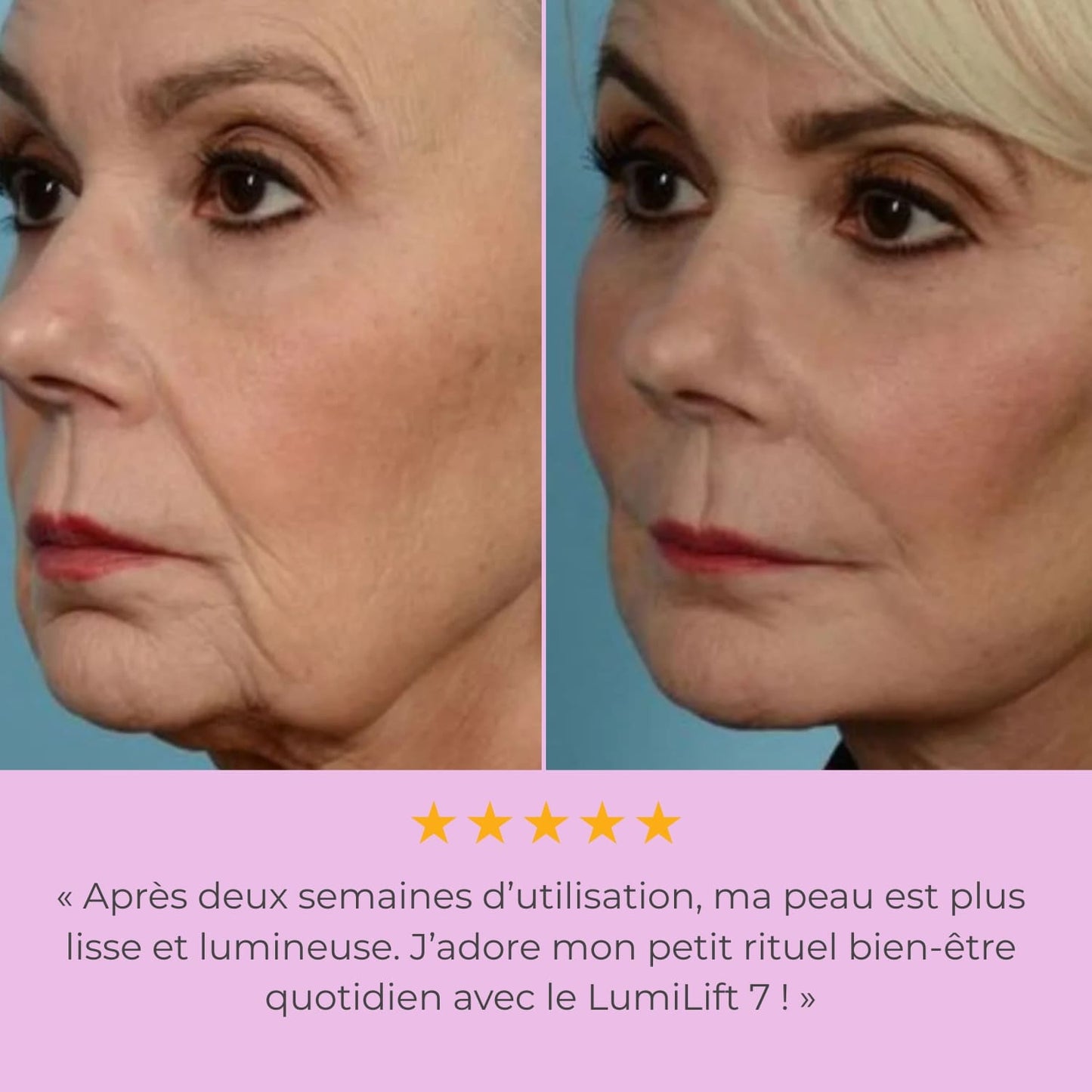 LumiLiFt 7 - Appareil de raffermissement du visage