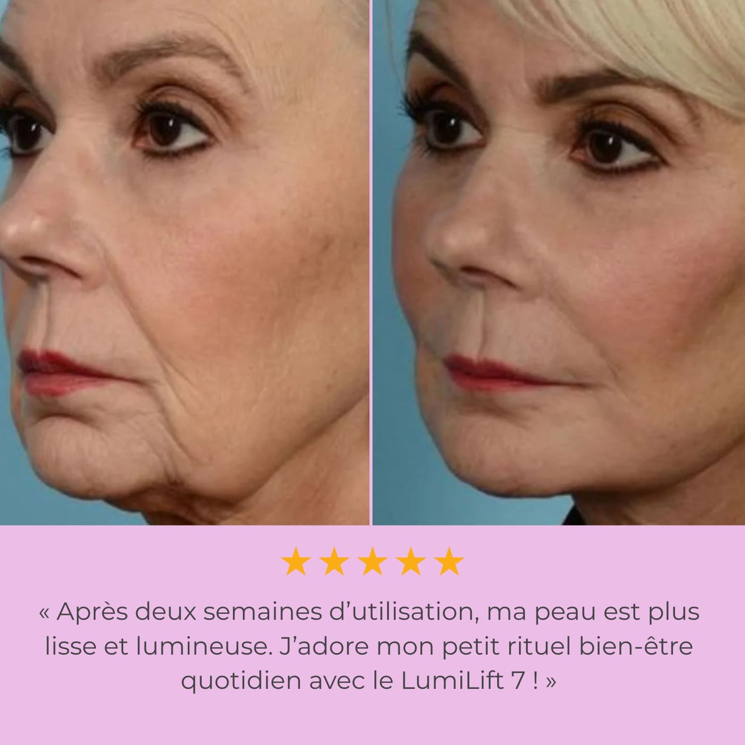 LumiLiFt 7 - Appareil de raffermissement du visage