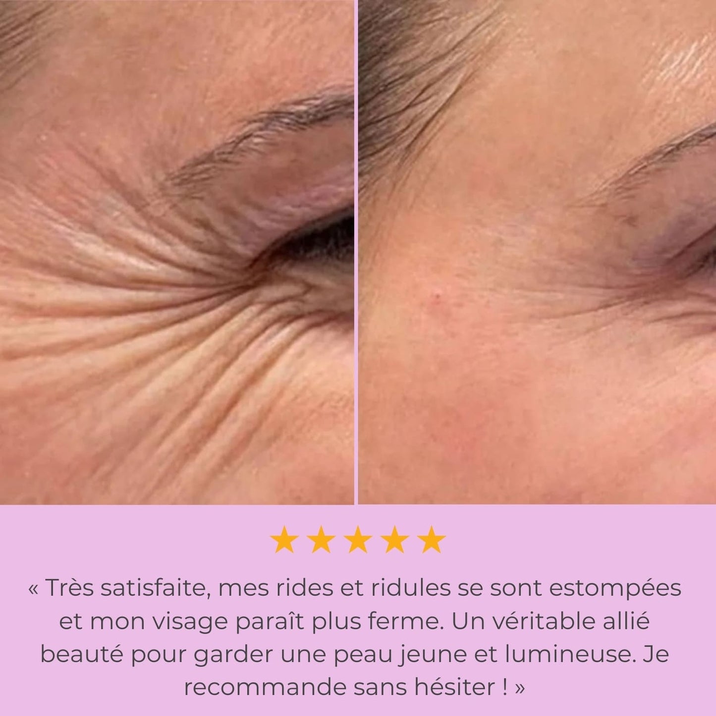 LumiLiFt 7 - Appareil de raffermissement du visage
